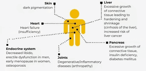 Diagnosis and therapy of AA: Areas of potential iron overload
